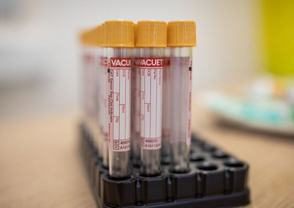 Último dia para matrículas na primeira chamada do Sisu