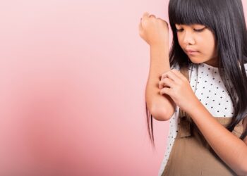 Cemig reforça cuidados necessários com a energia elétrica nas festas juninas