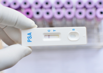 Dia D, para coleta do exame de PSA acontece nesse sábado em Araxá