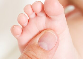 Teste do pezinho: pediatra da Unimed Araxá tira dúvidas sobre esse exame essencial para o recém-nascido