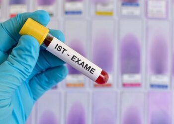 Sacramento realiza mutirão de exames para detectar Infecções Sexualmente Transmissíveis